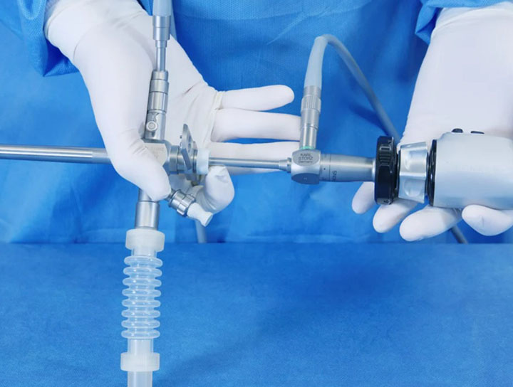 Rigid Bronchoscopy